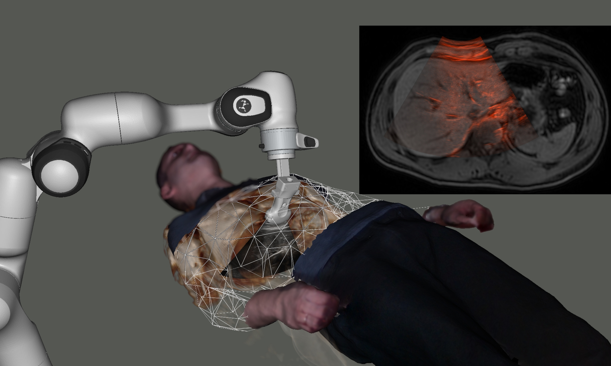 Multi-modal Image Registration