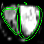 fimh2013-fastem.png