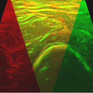 pocus2018.png