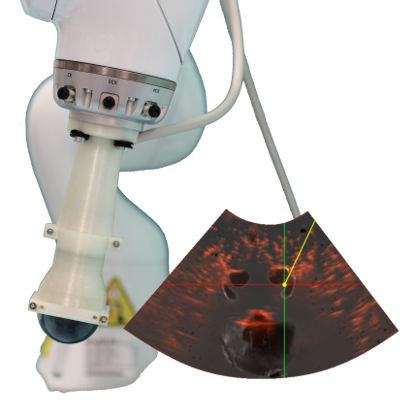 teaserphd.png