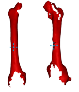 Femur reconstruction in 3D ultrasound for orthopedic surgery planning